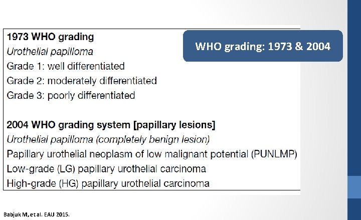 WHO grading: 1973 & 2004 Babjuk M, et al. EAU 2015. 