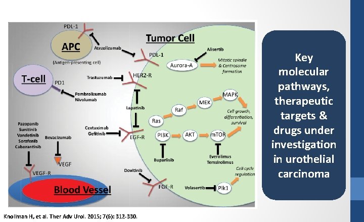 Key molecular pathways, therapeutic targets & drugs under investigation in urothelial carcinoma Knollman H,