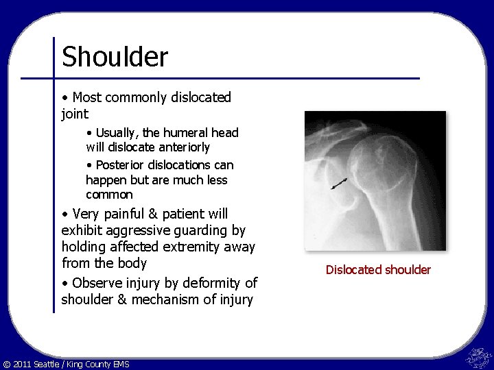 Shoulder • Most commonly dislocated joint • Usually, the humeral head will dislocate anteriorly