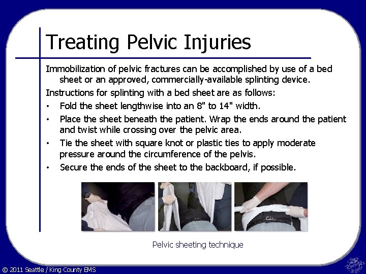 Treating Pelvic Injuries Immobilization of pelvic fractures can be accomplished by use of a