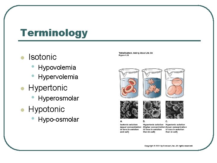 Terminology l l l Isotonic • • Hypovolemia Hypertonic • Hyperosmolar Hypotonic • Hypo-osmolar