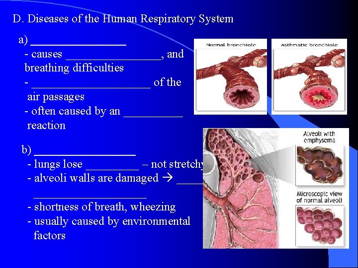 D. Diseases of the Human Respiratory System a) ________ - causes ________, and breathing