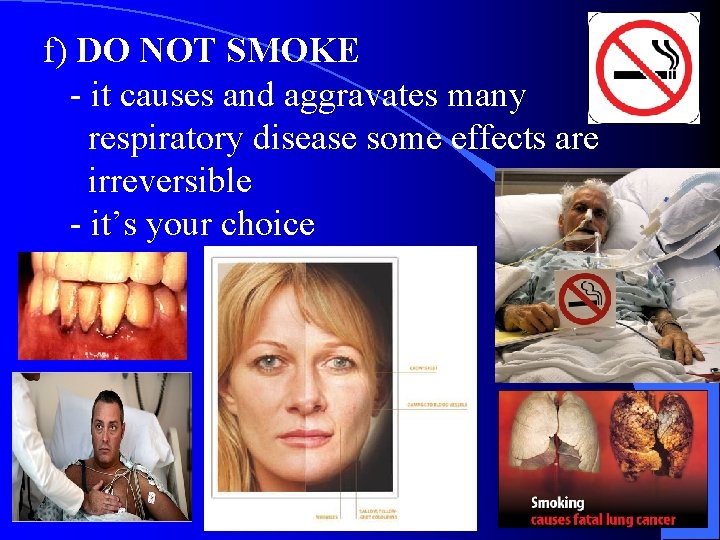 f) DO NOT SMOKE - it causes and aggravates many respiratory disease some effects