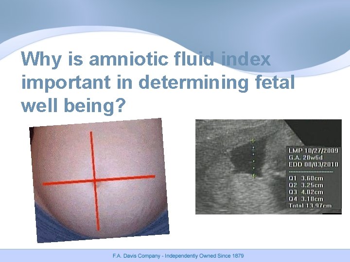 Why is amniotic fluid index important in determining fetal well being? 