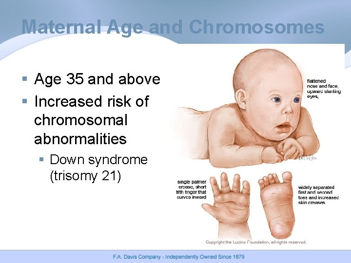 Maternal Age and Chromosomes § Age 35 and above § Increased risk of chromosomal