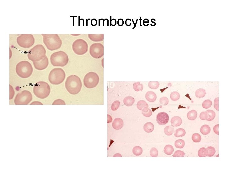 Thrombocytes Thrombocytes