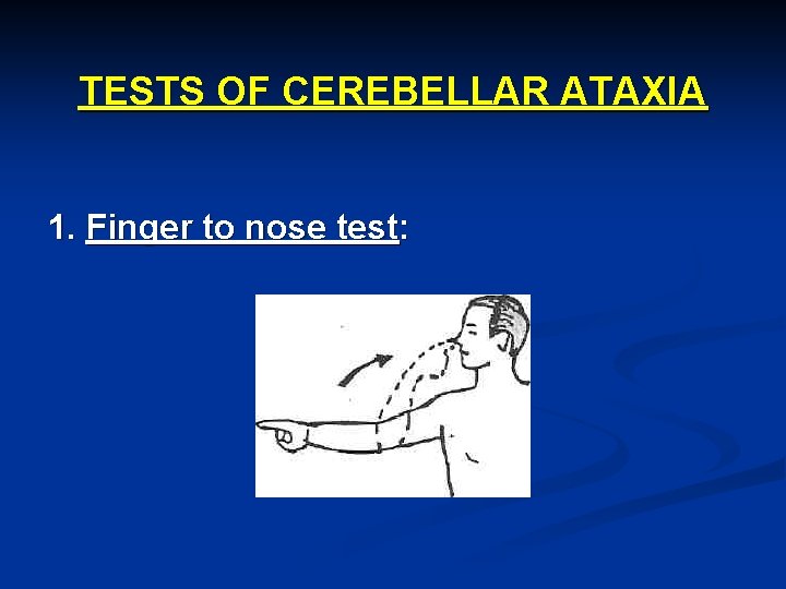 TESTS OF CEREBELLAR ATAXIA 1. Finger to nose test: 