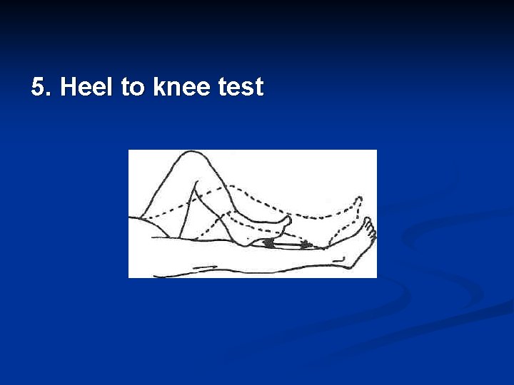 5. Heel to knee test 