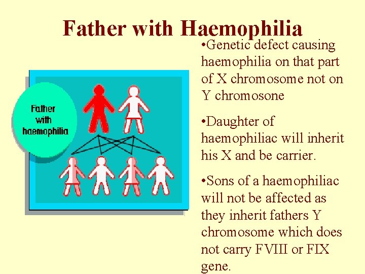 Father with Haemophilia • Genetic defect causing haemophilia on that part of X chromosome