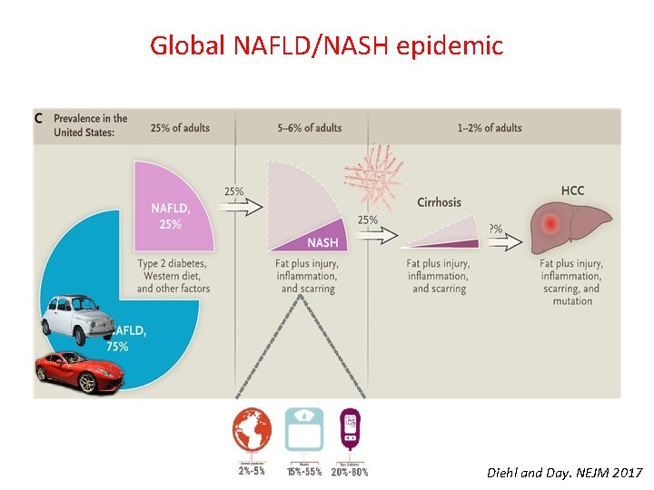 Global NAFLD/NASH epidemic Diehl and Day. NEJM 2017 