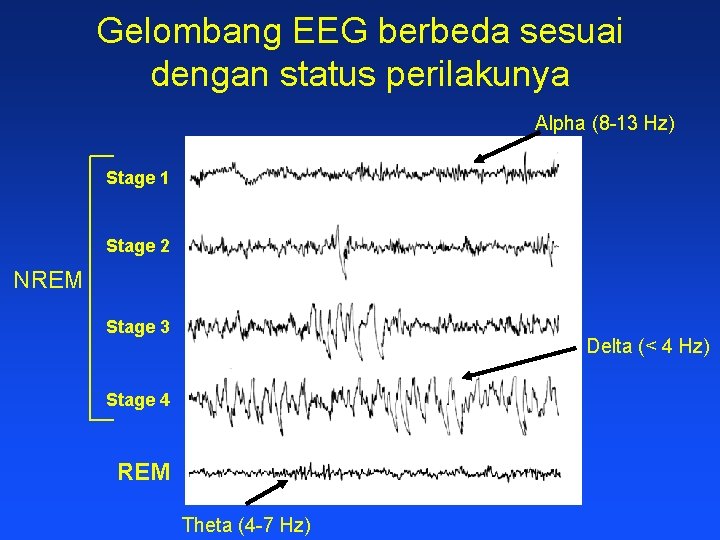 Gelombang EEG berbeda sesuai dengan status perilakunya Alpha (8 -13 Hz) Stage 1 Stage