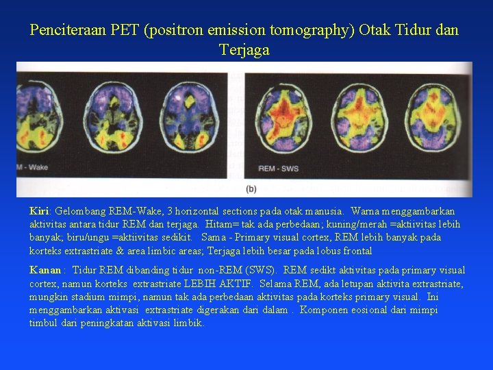 Penciteraan PET (positron emission tomography) Otak Tidur dan Terjaga Kiri: Gelombang REM-Wake, 3 horizontal