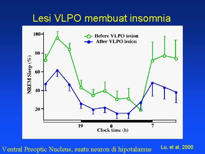 Lesi VLPO membuat insomnia Ventral Preoptic Nucleus, suatu neuron di hipotalamus Lu, et al,