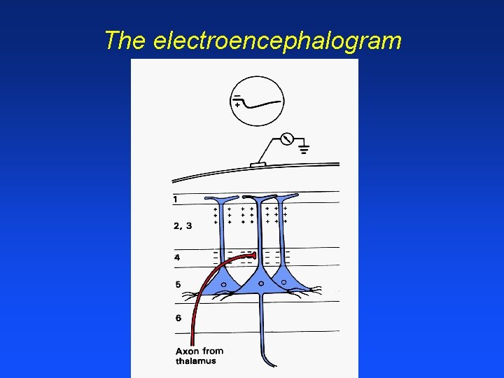 The electroencephalogram 