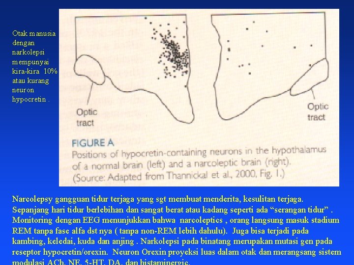 Otak manusia dengan narkolepsi mempunyai kira-kira 10% atau kurang neuron hypocretin. Narcolepsy gangguan tidur