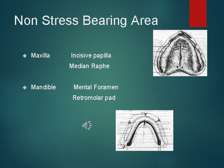 Non Stress Bearing Area Maxilla Incisive papilla Median Raphe Mandible Mental Foramen Retromolar pad
