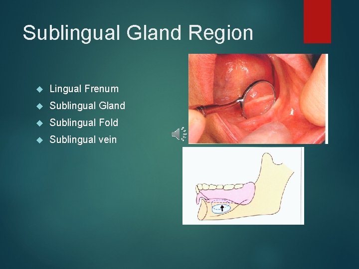 Sublingual Gland Region Lingual Frenum Sublingual Gland Sublingual Fold Sublingual vein 