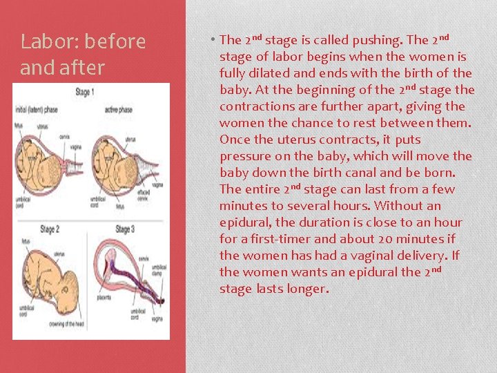 Labor: before and after • The 2 nd stage is called pushing. The 2