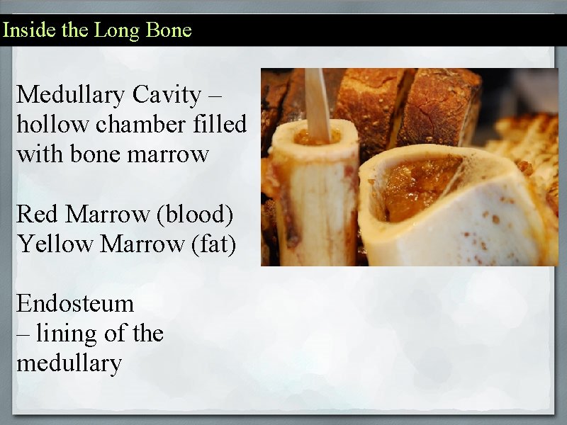 Inside the Long Bone Medullary Cavity – hollow chamber filled with bone marrow Red