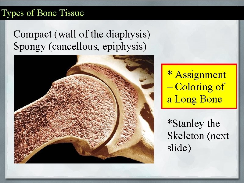Types of Bone Tissue Compact (wall of the diaphysis) Spongy (cancellous, epiphysis) * Assignment