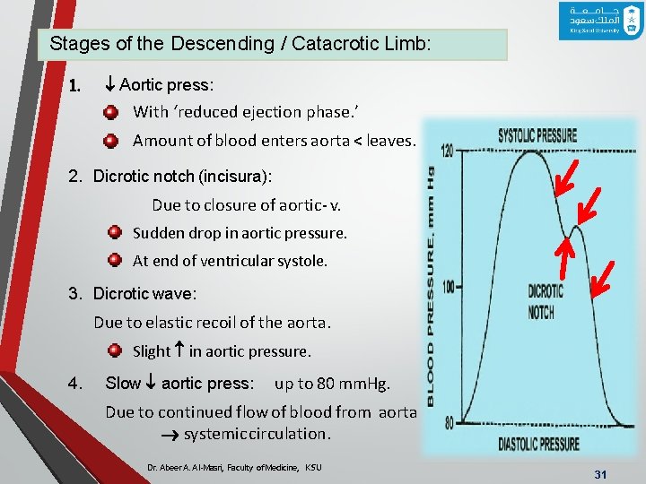 Stages of the Descending / Catacrotic Limb: 1. Aortic press: With ‘reduced ejection phase.