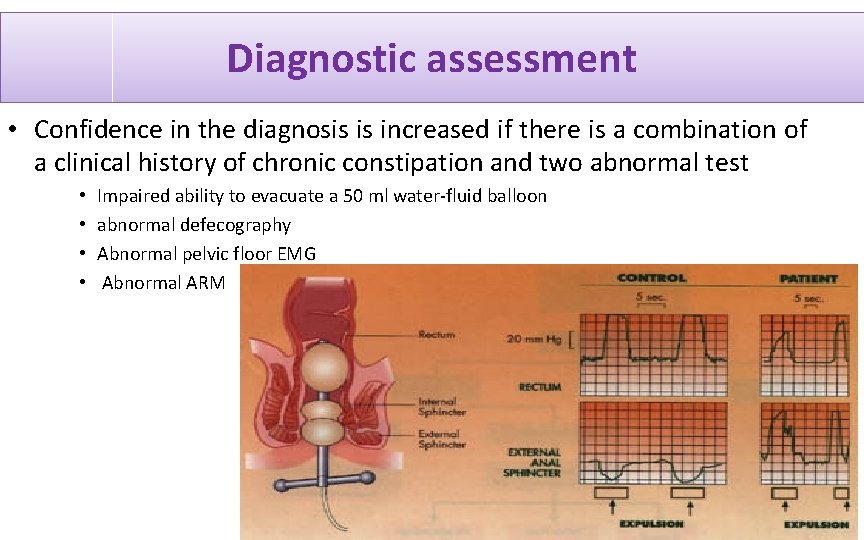Diagnostic assessment • Confidence in the diagnosis is increased if there is a combination