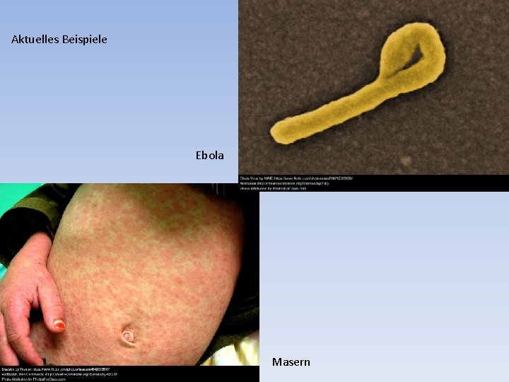 Aktuelles Beispiele Ebola Masern 