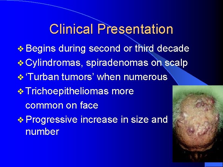 Clinical Presentation v Begins during second or third decade v Cylindromas, spiradenomas on scalp