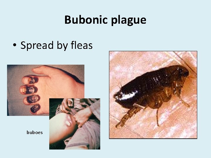 Bubonic plague • Spread by fleas buboes 