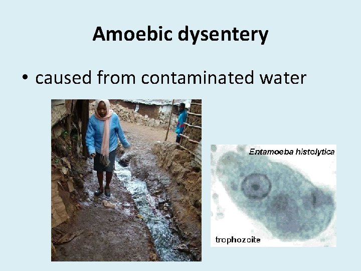 Amoebic dysentery • caused from contaminated water 