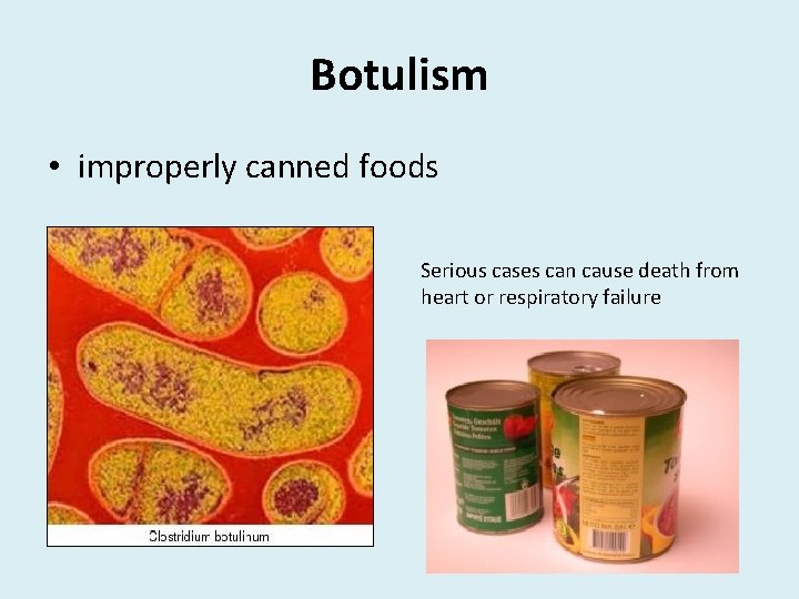 Botulism • improperly canned foods Serious cases can cause death from heart or respiratory