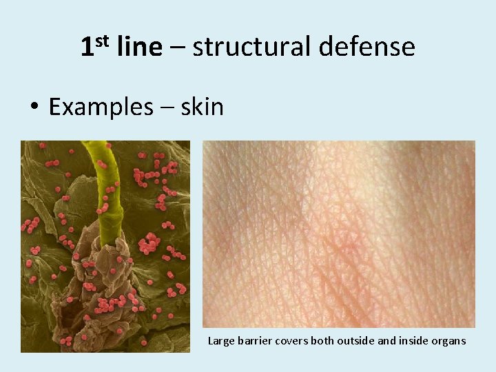 1 st line – structural defense • Examples – skin Large barrier covers both