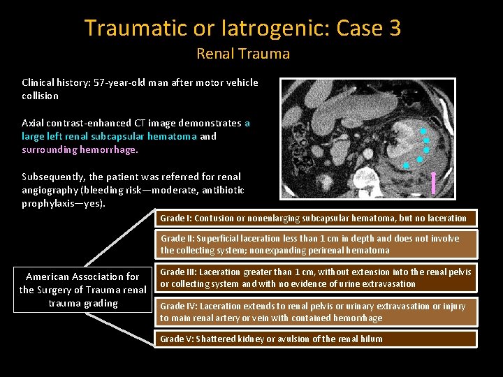 Traumatic or Iatrogenic: Case 3 Renal Trauma Clinical history: 57 -year-old man after motor