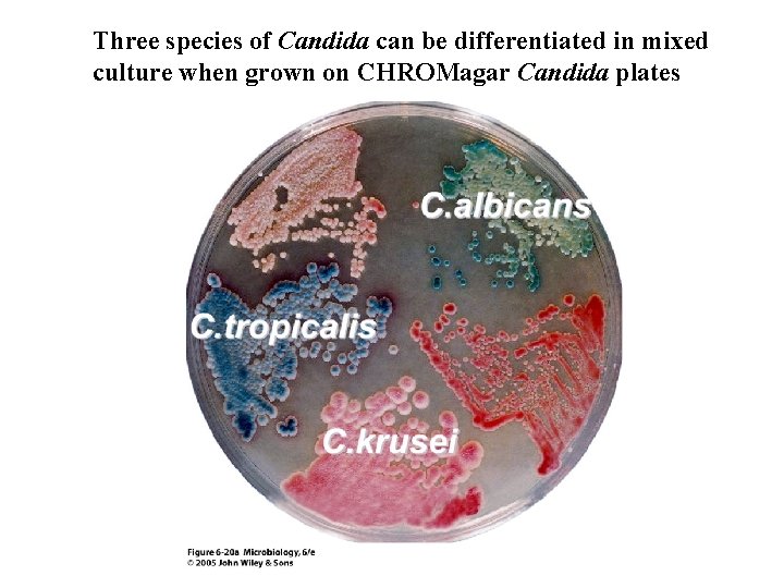 Three species of Candida can be differentiated in mixed culture when grown on CHROMagar