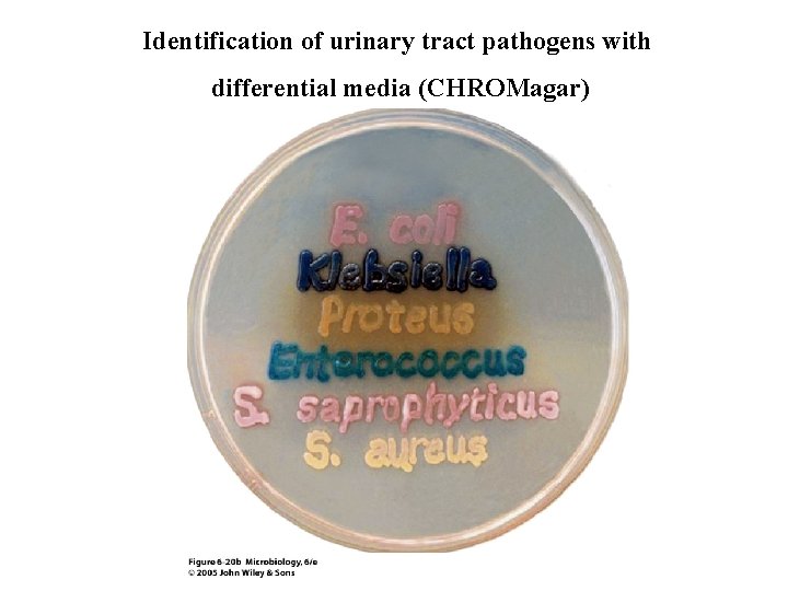 Identification of urinary tract pathogens with differential media (CHROMagar) 