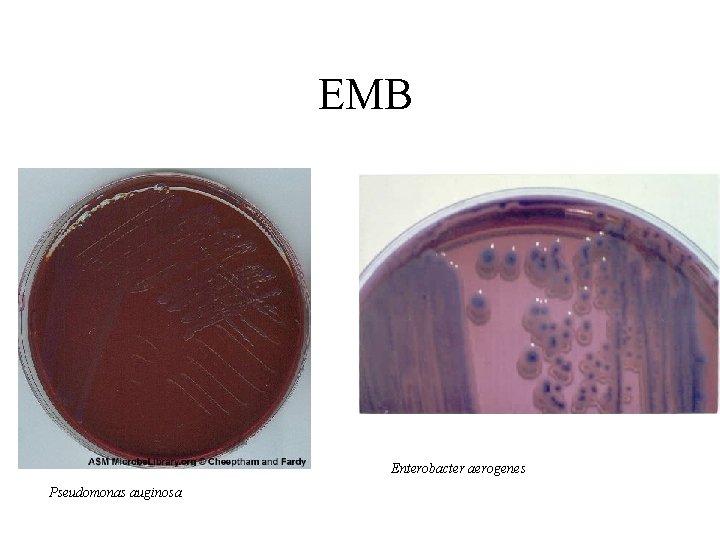 EMB Enterobacter aerogenes Pseudomonas auginosa 