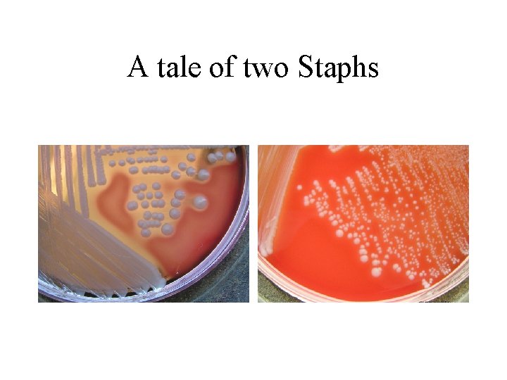 A tale of two Staphs 