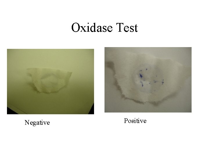 Oxidase Test Negative Positive 