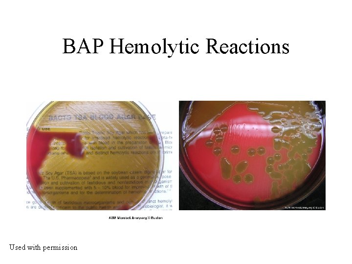 BAP Hemolytic Reactions Used with permission 