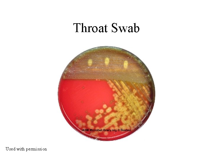 Throat Swab Used with permission 