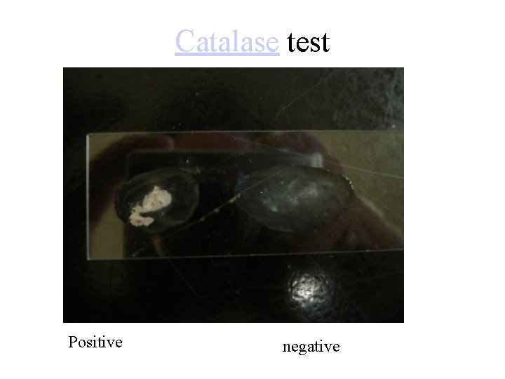 Catalase test Positive negative 