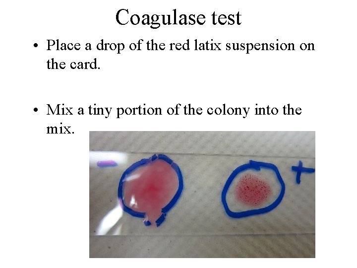 Coagulase test • Place a drop of the red latix suspension on the card.