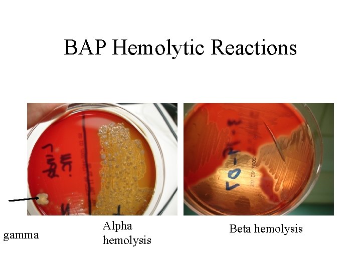 BAP Hemolytic Reactions gamma Alpha hemolysis Beta hemolysis 