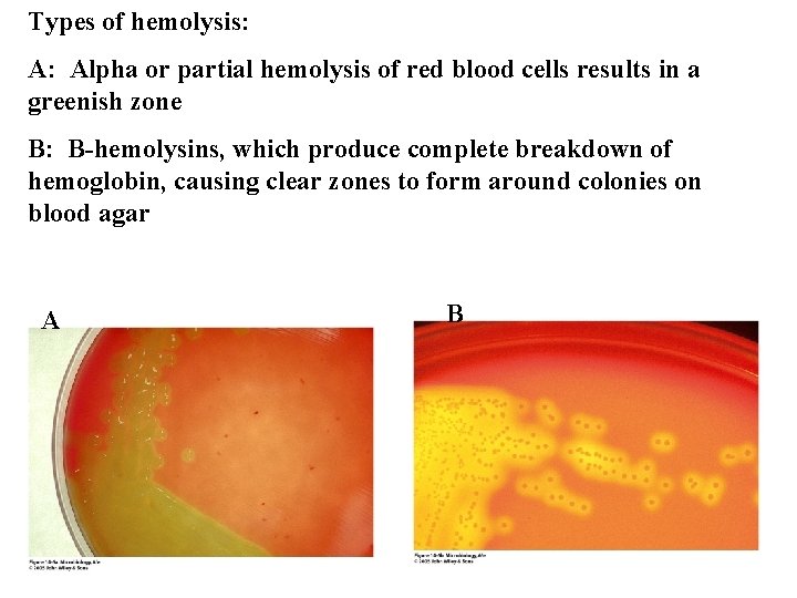 Types of hemolysis: A: Alpha or partial hemolysis of red blood cells results in