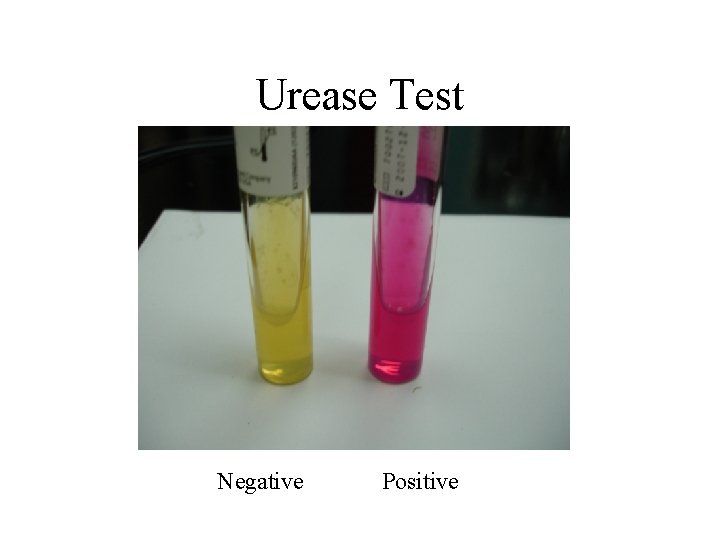 Urease Test Negative Positive 