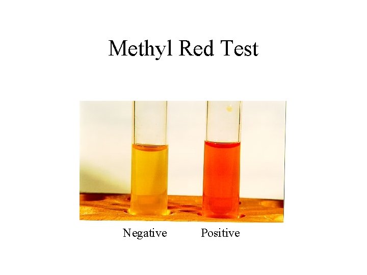 Methyl Red Test Negative Positive 