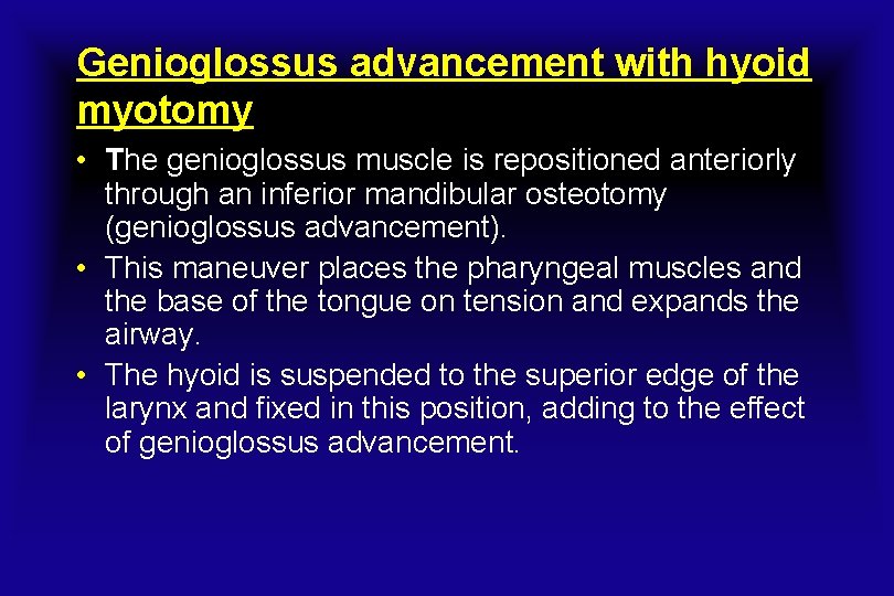Genioglossus advancement with hyoid myotomy • The genioglossus muscle is repositioned anteriorly through an