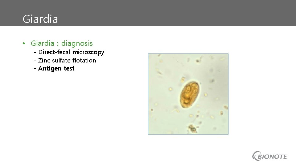 Giardia • Giardia : diagnosis - Direct-fecal microscopy - Zinc sulfate flotation - Antigen