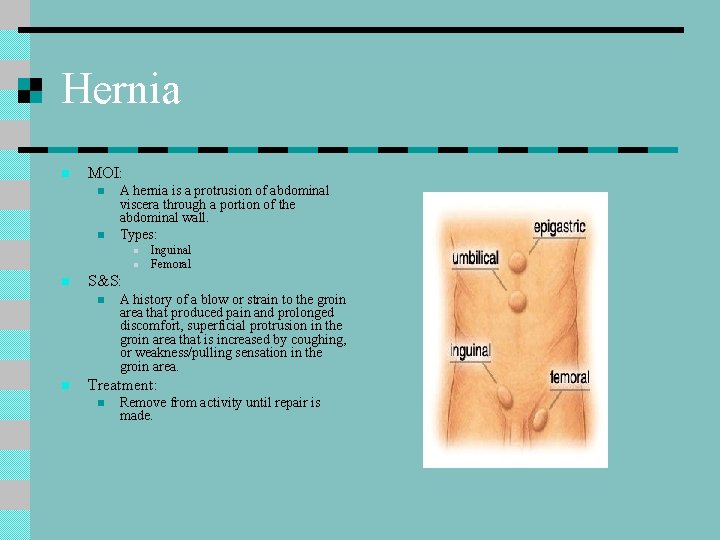 Hernia n MOI: n n A hernia is a protrusion of abdominal viscera through