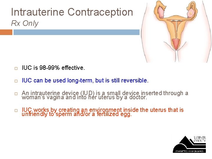 Intrauterine Contraception Rx Only IUC is 98 -99% effective. IUC can be used long-term,